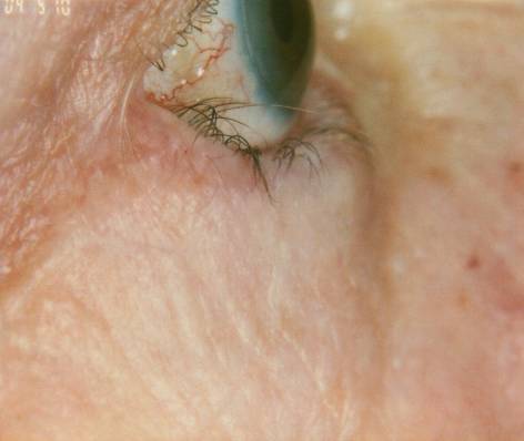 Case 12 after