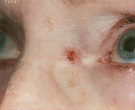 Case 14 after