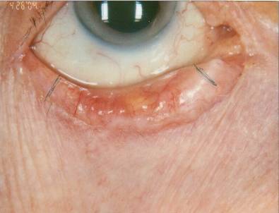 Case 15 after