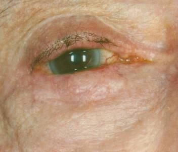 Case 15 before