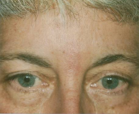Case 20 after