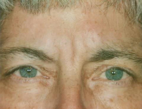Case 20 before