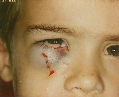 Case 24 after