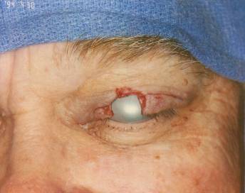 Case 25 after