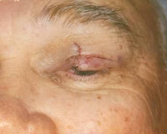 Case 25 before