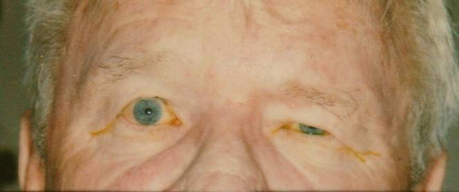 Case 26 after