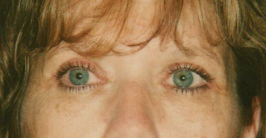 Case 27 before