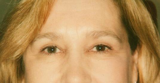 Case 28 after