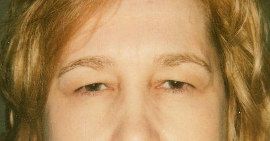 Case 28 before