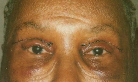 Case 4 after