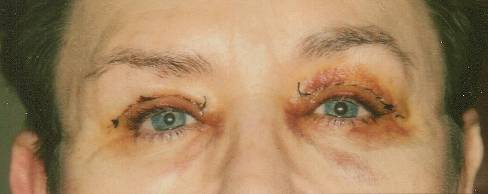 Case 36 after