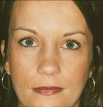 Case 37 before