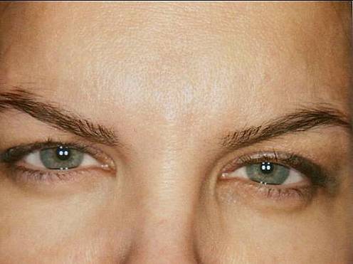 Case 39 after