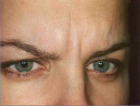 Case 39 before