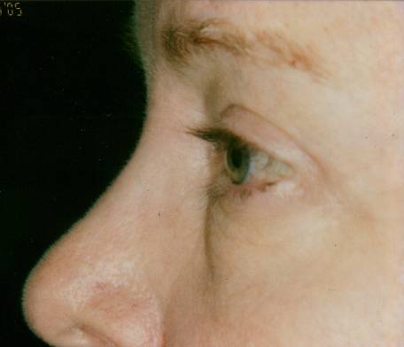Case 5 after