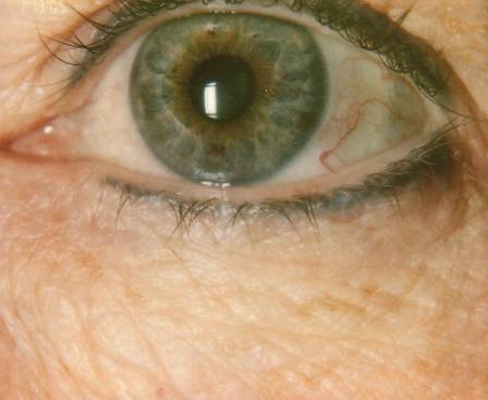 Case 47 before