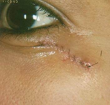 Case 48 after